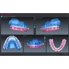 Kép 5/5 - Romexis CMF Surgery