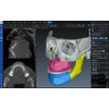 Kép 1/5 - Romexis CMF Surgery