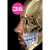 Kép 4/9 - Planmeca ProMax 3D Classic