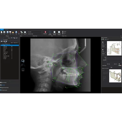 Romexis Cephalometric Ananlysis