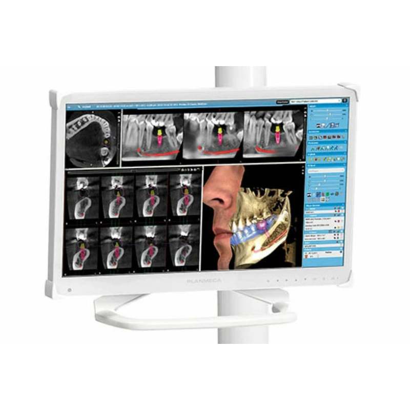 Planmeca Serenus 22" Full HD orvosi monitor