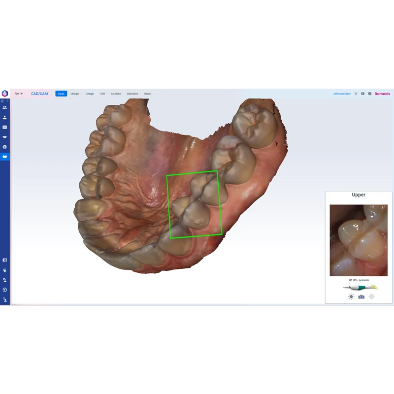 Romexis CAD/CAM Module