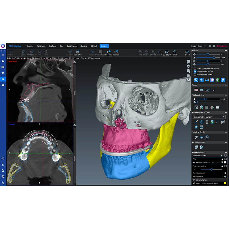 Romexis CMF Surgery