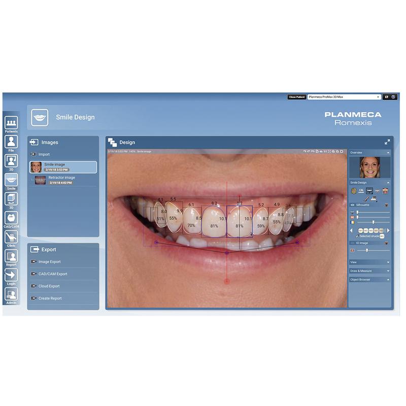 Romexis Smile Design Modul