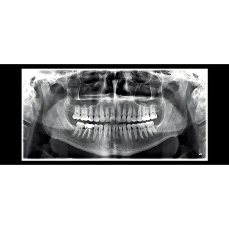 Planmeca ProMax 2D S3