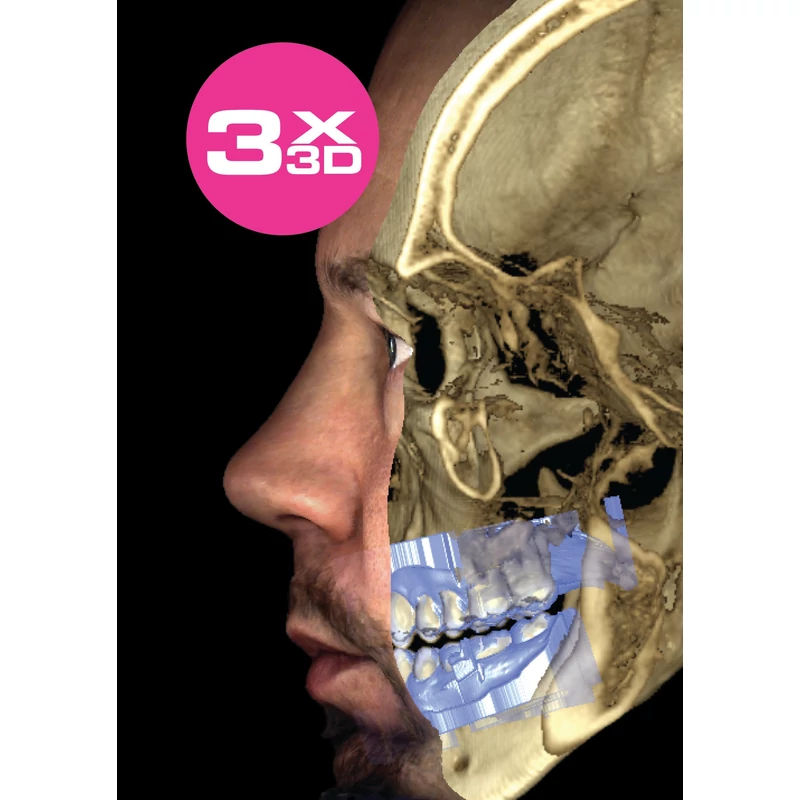 Planmeca ProMax 3D Classic